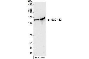 Western Blotting (WB) image for anti-PDS5, Regulator of Cohesion Maintenance, Homolog A (PDS5A) (C-Term) antibody (ABIN7449578)