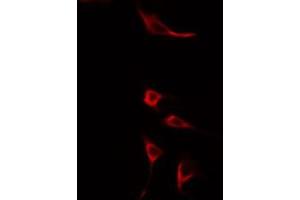 ABIN6275602 staining HuvEc cells by IF/ICC. (Sorting Nexin 4 antibody  (Internal Region))