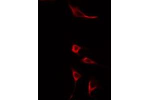 ABIN6275602 staining HuvEc cells by IF/ICC.