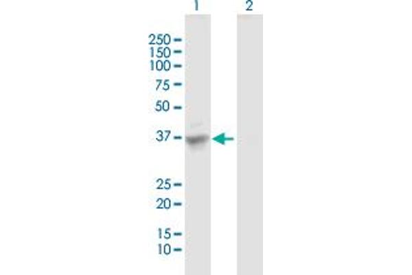 SULT1C3 antibody