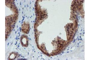 Image no. 9 for anti-Mannose Phosphate Isomerase (MPI) antibody (ABIN1499545) (MPI antibody)