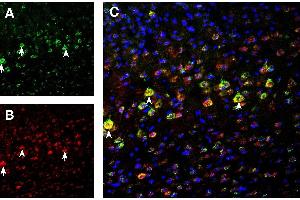 anti-Glutamate Receptor, Ionotropic, N-Methyl D-Aspartate 3B (GRIN3B) (AA 363-376), (Extracellular) antibody