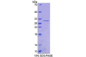 SDS-PAGE (SDS) image for Aspartylglucosaminidase (AGA) (AA 28-245) protein (His tag) (ABIN4989160)