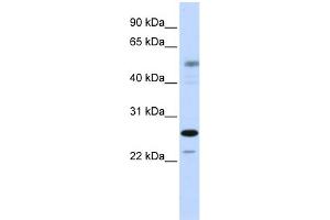 WB Suggested Anti-PSMC3IP Antibody Titration:  0. (PSMC3IP antibody  (C-Term))