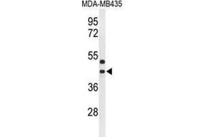 Western blot analysis of GPR17 (arrow) in MDA-MB435 cell line lysates (35ug/lane) using GPR17 (GPR17 antibody  (Middle Region))