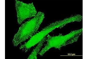 Immunofluorescence of monoclonal antibody to ITGB7 on HeLa cell. (Integrin beta 7 antibody  (AA 401-505))