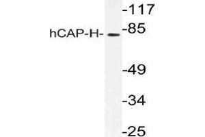 Western blot (WB) analysis of hCAP-H antibody in extracts from K562 cells.