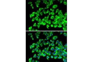 Immunofluorescence analysis of MCF7 cells using RPL13 antibody (ABIN1682571, ABIN5664631, ABIN5664633 and ABIN6220492). (RPL13 antibody  (AA 1-211))