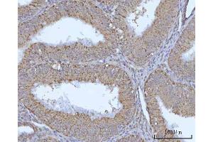 IHC analysis of OCRL using anti-OCRL antibody (ABIN7599572). (OCRL antibody  (AA 1-901))