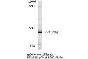 Western blot (WB) analyzes of P53 antibody in extracts from SP20 cells. (p53 antibody)