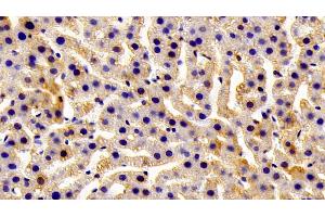 Immunohistochemistry (IHC) image for anti-Glutathione S-Transferase mu 1 (GSTM1) (AA 1-218) antibody (ABIN7436972)