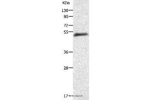Western blot analysis of Human liver cancer tissue, using AGT Polyclonal Antibody at dilution of 1:200