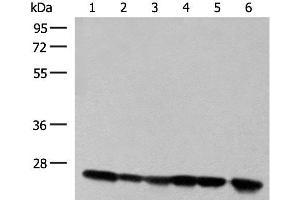 Western blot analysis of 293T cell and Human fetal liver tissue lysates using DTYMK Polyclonal Antibody at dilution of 1:550 (DTYMK antibody)