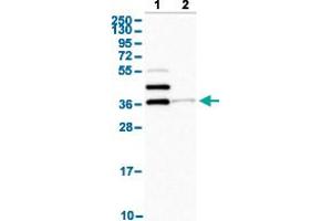 Western Blot analysis with SLAMF6 polyclonal antibody . (SLAMF6 antibody  (AA 152-224))