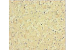 Immunohistochemistry of paraffin-embedded human liver tissue using ABIN7147993 at dilution of 1:100 (Factor XI antibody  (AA 19-387))