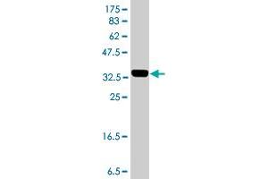 Western Blot detection against Immunogen (36. (PGK1 antibody  (AA 321-417))