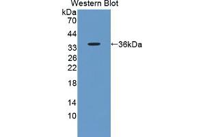 Detection of Recombinant AKAP12, Human using Polyclonal Antibody to A Kinase Anchor Protein 12 (AKAP12) (AKAP12 antibody  (AA 1485-1782))
