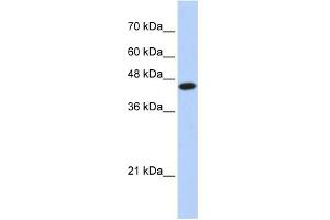 WB Suggested Anti-E2F1 Antibody Titration:  0. (E2F1 antibody  (N-Term))
