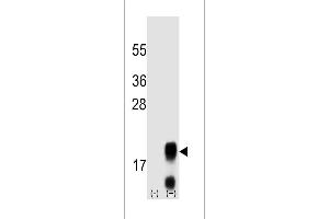 Western blot analysis of FSHB/FSH (arrow) using mouse polyclonal FSHB/FSH antibody (Center) (ABIN658910 and ABIN2837836). (FSHB antibody  (AA 36-64))