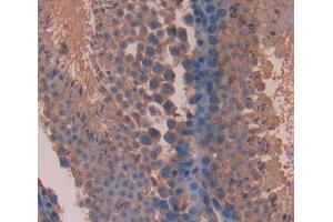 #VALUE! (Olfactomedin 3 antibody  (AA 245-406))