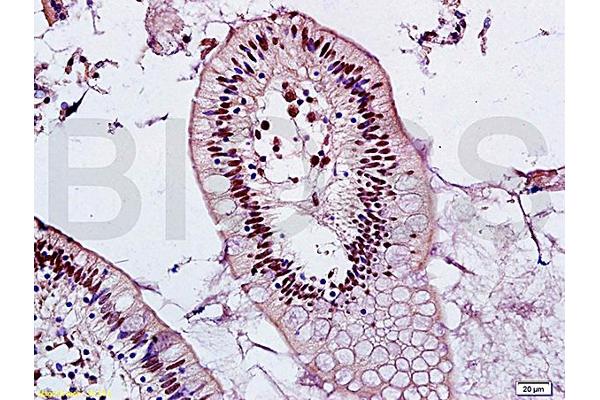 PCGF2 antibody  (AA 170-210)