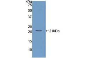 Detection of Recombinant ARPC4, Human using Polyclonal Antibody to Actin Related Protein 2/3 Complex Subunit 4 (ARPC4) (ARPC4 antibody  (AA 3-165))