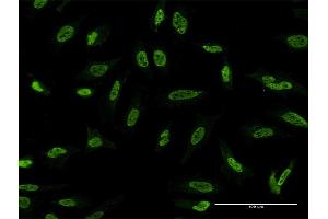 Immunofluorescence of monoclonal antibody to STK24 on HeLa cell. (STK24 antibody  (AA 1-431))