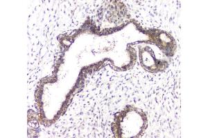 IHC analysis of RHOB using anti-RHOB antibody (ABIN6719538). (RHOB antibody)