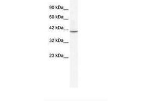 Image no. 2 for anti-T-Box 1 (TBX1) (AA 396-445) antibody (ABIN202658) (T-Box 1 antibody  (AA 396-445))