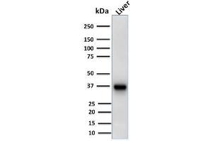 Western Blotting (WB) image for anti-alpha-Methylacyl-CoA Racemase (AMACR) antibody (ABIN6939430)