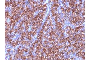 Immunohistochemistry (IHC) image for anti-Chromogranin A (CHGA) antibody (ABIN6939135)