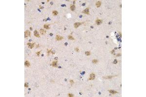 Immunohistochemistry of paraffin-embedded mouse brain using CDC25A antibody at dilution of 1:200 (400x lens). (CDC25A antibody)