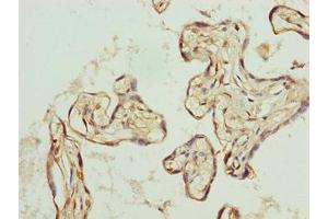 Immunohistochemistry of paraffin-embedded human placenta tissue using ABIN7162475 at dilution of 1:100 (TRIP13 antibody  (AA 181-390))