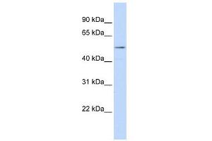 WB Suggested Anti-SUV420H1 AntibodyTitration: 1. (SUV420H1 antibody  (Middle Region))