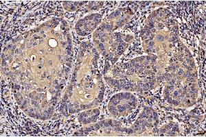 IHC analysis of PDIA6 using anti-PDIA6 antibody (ABIN7600554). (PDIA6 antibody  (AA 20-440))