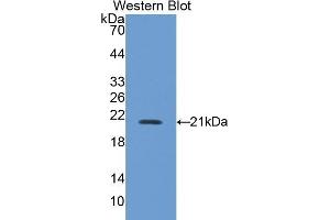 Detection of Recombinant NOS2, Mouse using Polyclonal Antibody to Nitric Oxide Synthase 2, Inducible (NOS2) (NOS2 antibody  (AA 43-213))