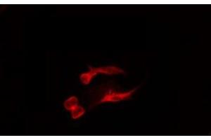 ABIN6275094 staining MCF7 by IF/ICC. (RNF138 antibody  (Internal Region))