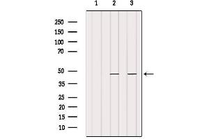 Western Blotting (WB) image for anti-DNA (Cytosine-5-)-Methyltransferase 3 Like (TRDMT1) (Internal Region) antibody (ABIN6261345)