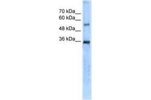 Image no. 1 for anti-Carbonic Anhydrase VIII (CA8) (AA 31-80) antibody (ABIN204988) (CA8 antibody  (AA 31-80))