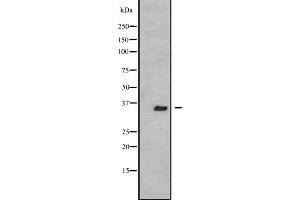 Western blot analysis of TSSK3 expression in A431 whole cell lysate ,The lane on the left is treated with the antigen-specific peptide. (TSSK3 antibody  (N-Term))