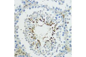 Immunohistochemistry of paraffin-embedded mouse testis using TRIP12 antibody (ABIN6129753, ABIN6149543, ABIN6149544 and ABIN6225295) at dilution of 1:100 (40x lens).
