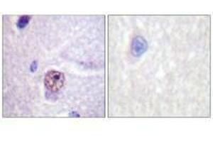 Immunohistochemistry analysis of paraffin-embedded human brain tissue using SF1 (Ab-82) antibody. (Splicing Factor 1 antibody  (Ser82))