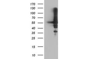 HEK293T cells were transfected with the pCMV6-ENTRY control (Left lane) or pCMV6-ENTRY AKT1 (Right lane) cDNA for 48 hrs and lysed. (AKT1 antibody)