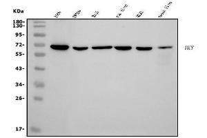 Western blot analysis of Transketolase/TKT using anti-Transketolase/TKT antibody (ABIN7598957). (TKT antibody  (AA 1-116))