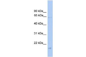 WB Suggested Anti-GK Antibody Titration: 0. (Glycerol Kinase antibody  (Middle Region))