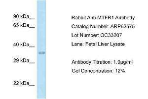 Western Blotting (WB) image for anti-Mitochondrial Fission Regulator 1 (MTFR1) (C-Term) antibody (ABIN2789182) (MTFR1 antibody  (C-Term))