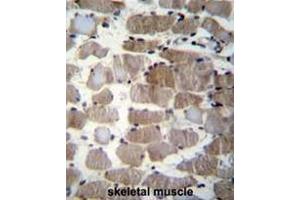 Formalin fixed and paraffin embedded human skeletal muscle stained with CTSK Antibody (Center) followed by peroxidase conjugation of the secondary antibody and DAB staining. (Cathepsin K antibody  (Middle Region))