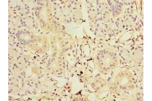 Immunohistochemistry of paraffin-embedded human pancreatic tissue using ABIN7153583 at dilution of 1:100 (GDAP1L1 antibody  (AA 101-260))