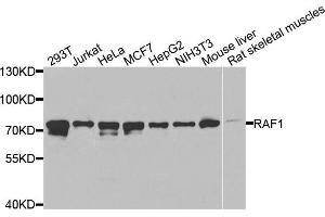 Western blot analysis of extracts of various cell lines, using RAF1 antibody (ABIN5970053) at 1/1000 dilution. (RAF1 antibody  (C-Term))