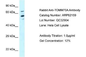 Western Blotting (WB) image for anti-Translocase of Outer Mitochondrial Membrane 70 (TOMM70A) (N-Term) antibody (ABIN786547) (TOM70 antibody  (N-Term))